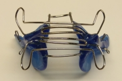 offener Biss-Aktivator mit Zungengitter 1