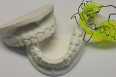 Feder-Aktivator nach Sander 2