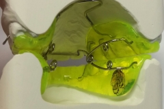 Feder-Aktivator nach Sander 3