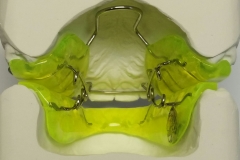 Feder-Aktivator nach Sander 4