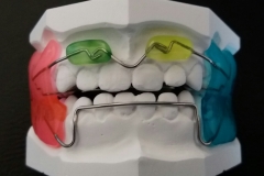 Funktionsregler nach Fränkel 1