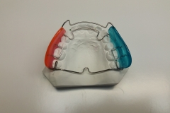 Funktionsregler nach Fränkel 4