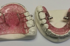 Rückschubdoppelplatte 1