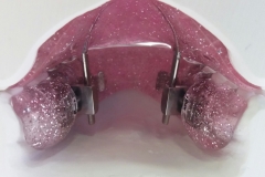 Rückschubdoppelplatte 2