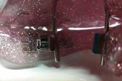 Rückschubdoppelplatte 3