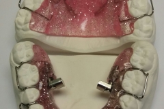 Rückschubdoppelplatte 4