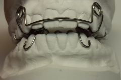 Skel-Aktivator nach Ruhland Typ III b 2