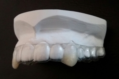 Vampirschiene 1